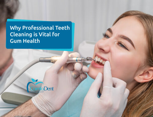 Why Professional Teeth Cleaning is Vital for Gum Health