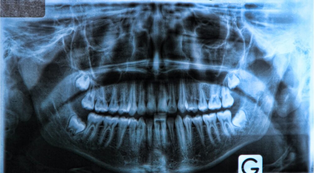 CBCT Image