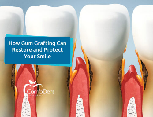 How Gum Grafting Can Restore and Protect Your Smile