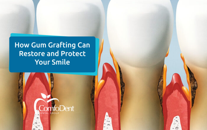 How Gum Grafting Can Restore and Protect Your Smile