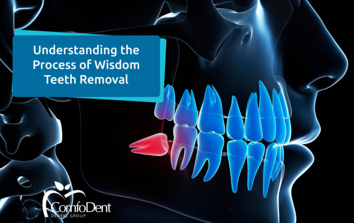 Process of Wisdom Teeth Removal