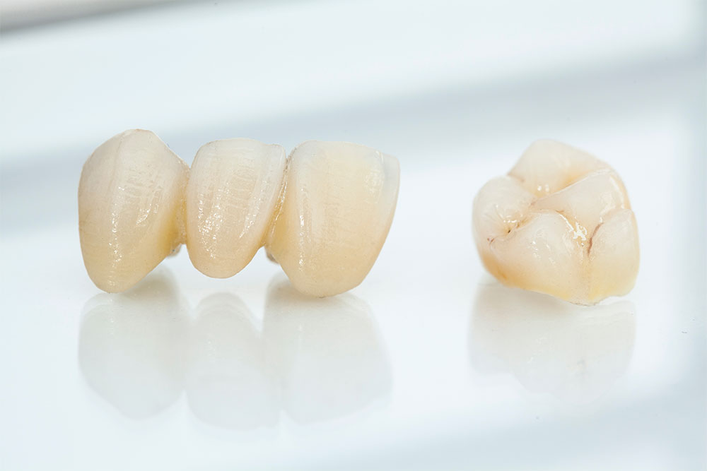 Dental Crowns Help Protect and Restore Your Smile