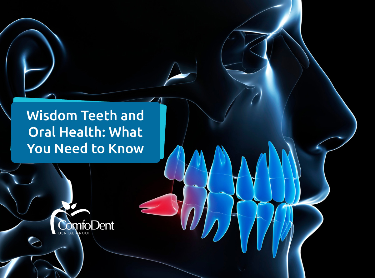 Wisdom Teeth and Oral Health: What You Need to Know