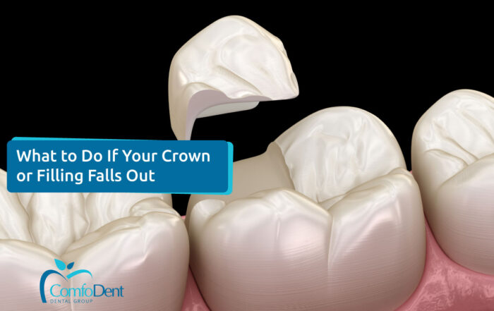 What to Do If Your Crown or Filling Falls Out